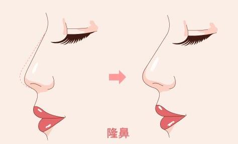 ע䲣¡ΣU¡g(sh)ЩL(fng)U