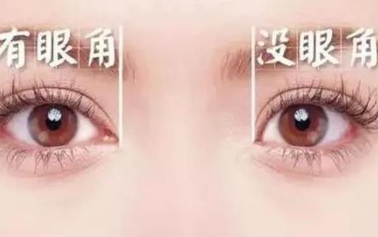 開眼角效果好嗎?開眼角會(huì)留疤嗎?