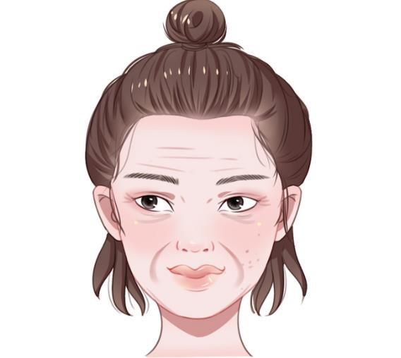 法令紋能徹底消除嗎 按摩護膚填充拉皮手術
