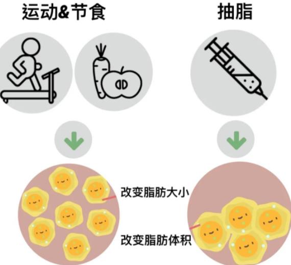 性感美臀怎么塑造?為什么臀部會下垂?