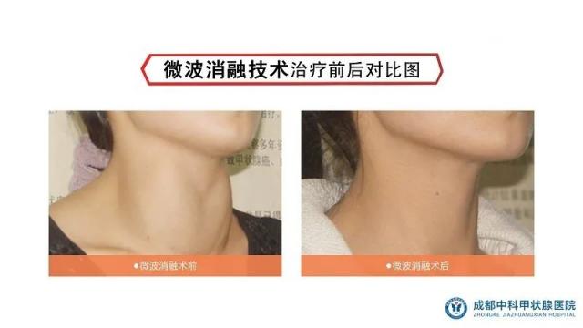 南京建國(guó)甲狀腺醫(yī)院檢查價(jià)格致力提高全民健康水平