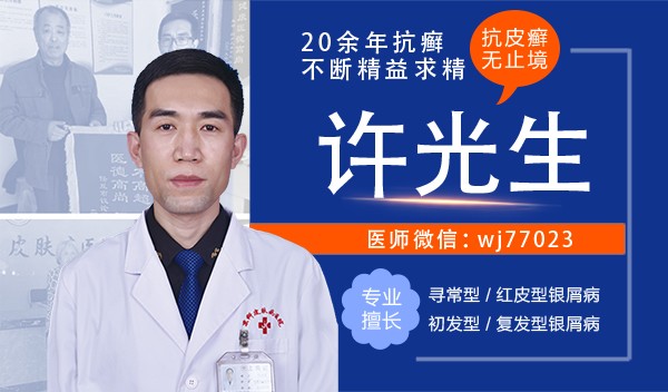 京科中醫許光生:銀屑病會癌變嗎 京科中醫許光生:銀屑病會癌變嗎