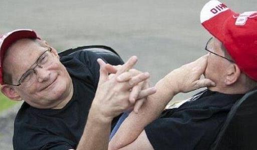 世界上最長壽的連體雙胞胎,他們即將迎來68歲生日