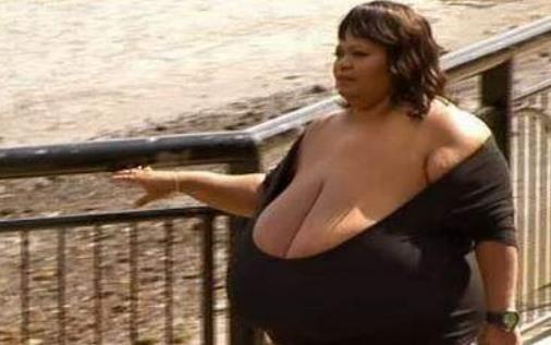 世界上最大的天然乳房 安妮·霍金斯·特納雙乳重達(dá)38.5公斤