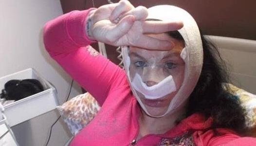 世界上整容最多的女人 美國女子整容36次揚言還會繼續整下去