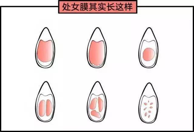 女性陰部真實照片:詳解健康女人真實完美陰道圖片【多圖】 女性陰部真實照片:詳解健康女人真實完美陰道圖片【多圖】