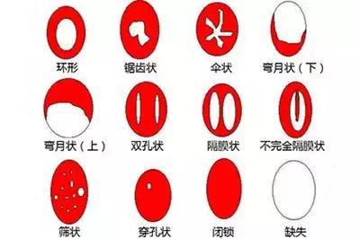 女性陰部真實照片:詳解健康女人真實完美陰道圖片【多圖】 女性陰部真實照片:詳解健康女人真實完美陰道圖片【多圖】