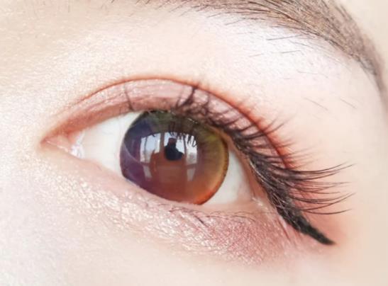 雙眼皮傷口發炎紅腫可以冰敷嗎?雙眼皮傷口發炎紅腫怎么辦 雙眼皮傷口發炎紅腫可以冰敷嗎?雙眼皮傷口發炎紅腫怎么辦