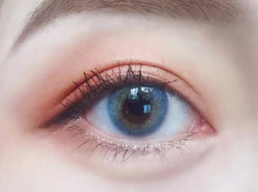 雙眼皮太寬太深可以修復嗎?雙眼皮疤痕凹陷能好嗎 雙眼皮太寬太深可以修復嗎?雙眼皮疤痕凹陷能好嗎