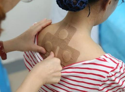 貼三伏貼需要把脈嗎?貼三伏貼可以喝涼茶嗎 貼三伏貼需要把脈嗎?貼三伏貼可以喝涼茶嗎