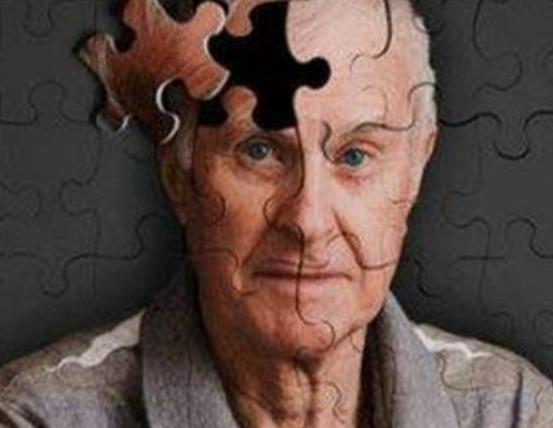 世界十大治不愈的病,慢性疲勞綜合癥、自身免疫失調都是慢性難治療 世界十大治不愈的病,慢性疲勞綜合癥、自身免疫失調都是慢性難治療
