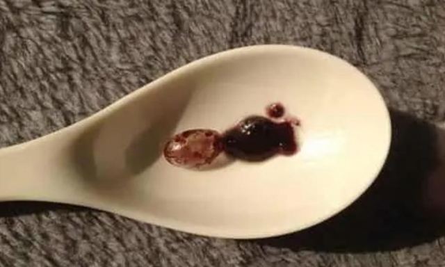 葡萄籽有毒嗎能吃嗎?一天中吃葡萄籽最佳時間 葡萄籽有毒嗎能吃嗎?一天中吃葡萄籽最佳時間