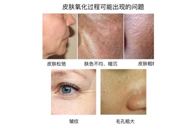 女性吃堅(jiān)果能幫助抗衰老嗎 堅(jiān)果的抗衰老作用大不大 女性吃堅(jiān)果能幫助抗衰老嗎 堅(jiān)果的抗衰老作用大不大