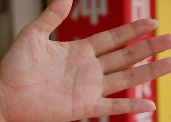 手指被自己掰粗了可以恢復(fù)嗎?掰手指關(guān)節(jié)響有沒(méi)有危害 手指被自己掰粗了可以恢復(fù)嗎?掰手指關(guān)節(jié)響有沒(méi)有危害