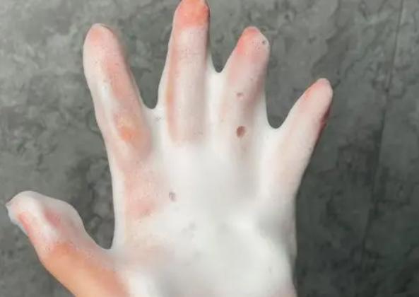 面部老出油是怎么回事 臉出油怎么緩解 面部老出油是怎么回事 臉出油怎么緩解