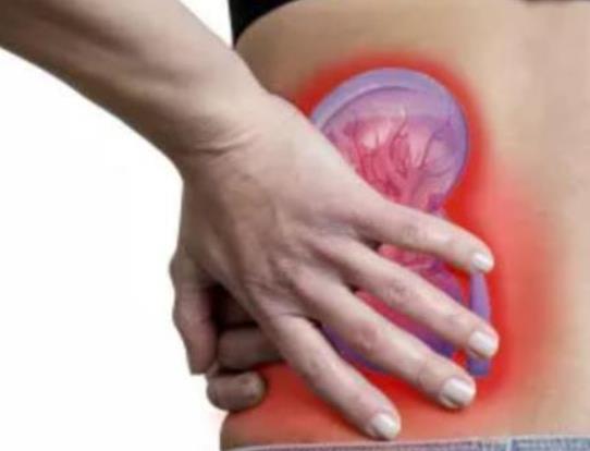腎結(jié)石會(huì)引起腎衰嗎?腎結(jié)石震碎后多久排出 腎結(jié)石會(huì)引起腎衰嗎?腎結(jié)石震碎后多久排出