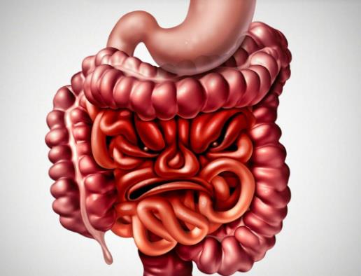 慢性結腸炎會怎么樣?結腸炎會引起什么 慢性結腸炎會怎么樣?結腸炎會引起什么