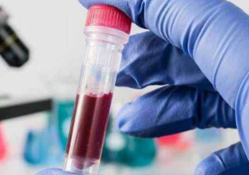 艾滋病要多少量才感染?HIV感染者有社保還需要買保險嗎 艾滋病要多少量才感染?HIV感染者有社保還需要買保險嗎